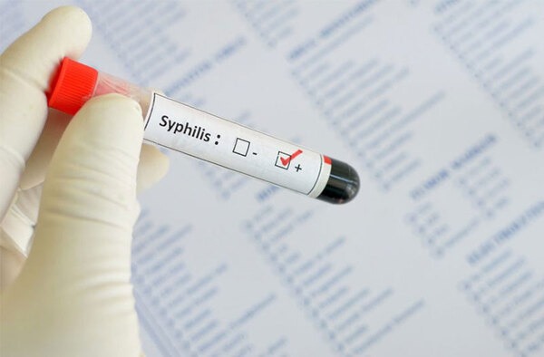 syphilis là gì